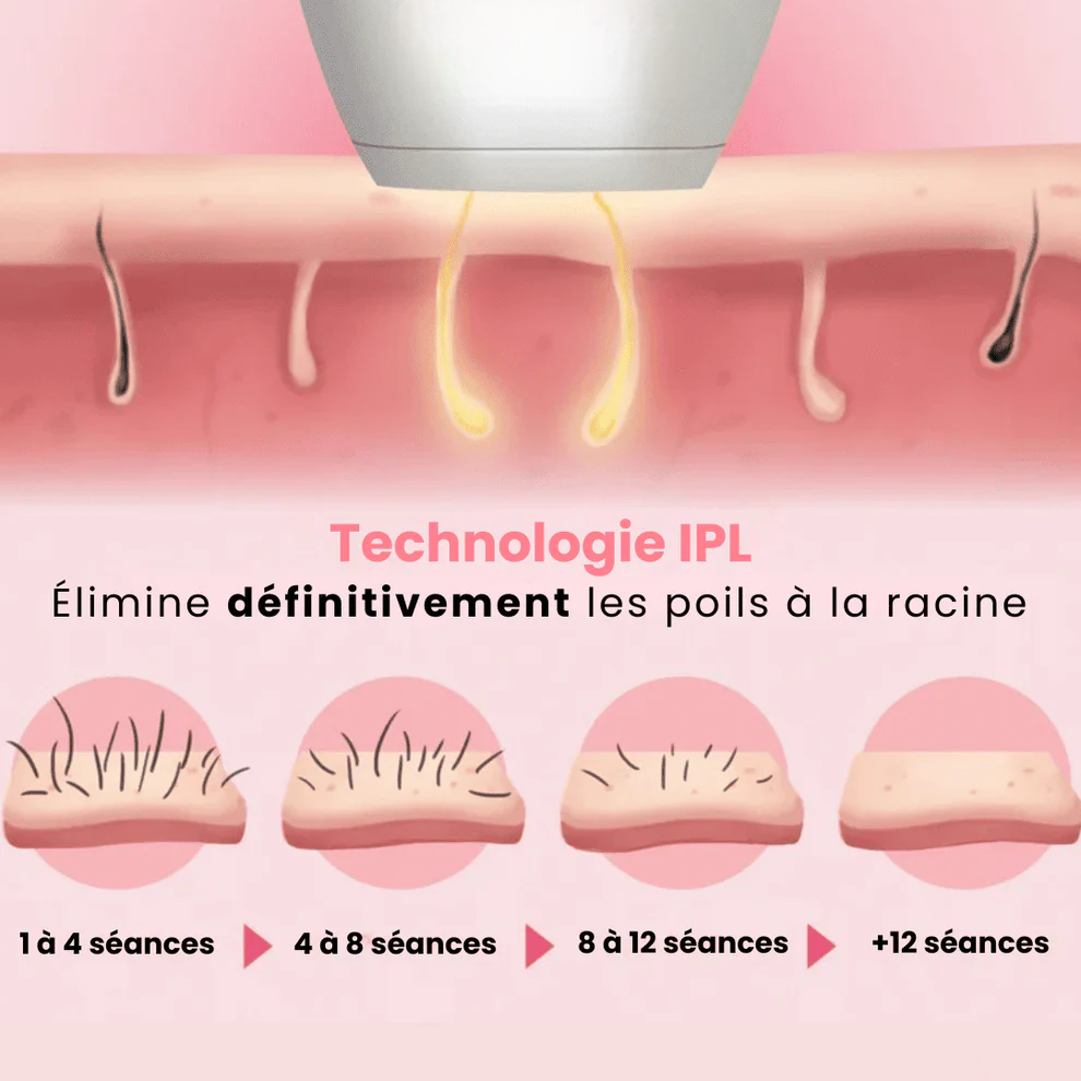 BLOOMY - ÉPILATEUR À LUMIÈRE PULSÉE
